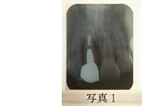 （写真1）