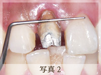 （写真2）