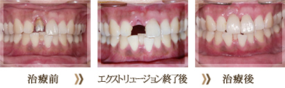 術前と術後の比較